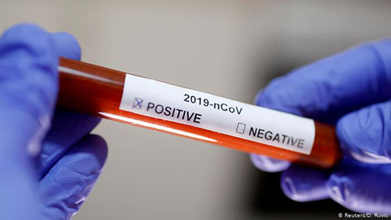 How and where to get tested for 2019-nCoV