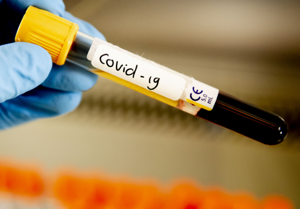 Are there tests for coronavirus in Nizhny Novgorod